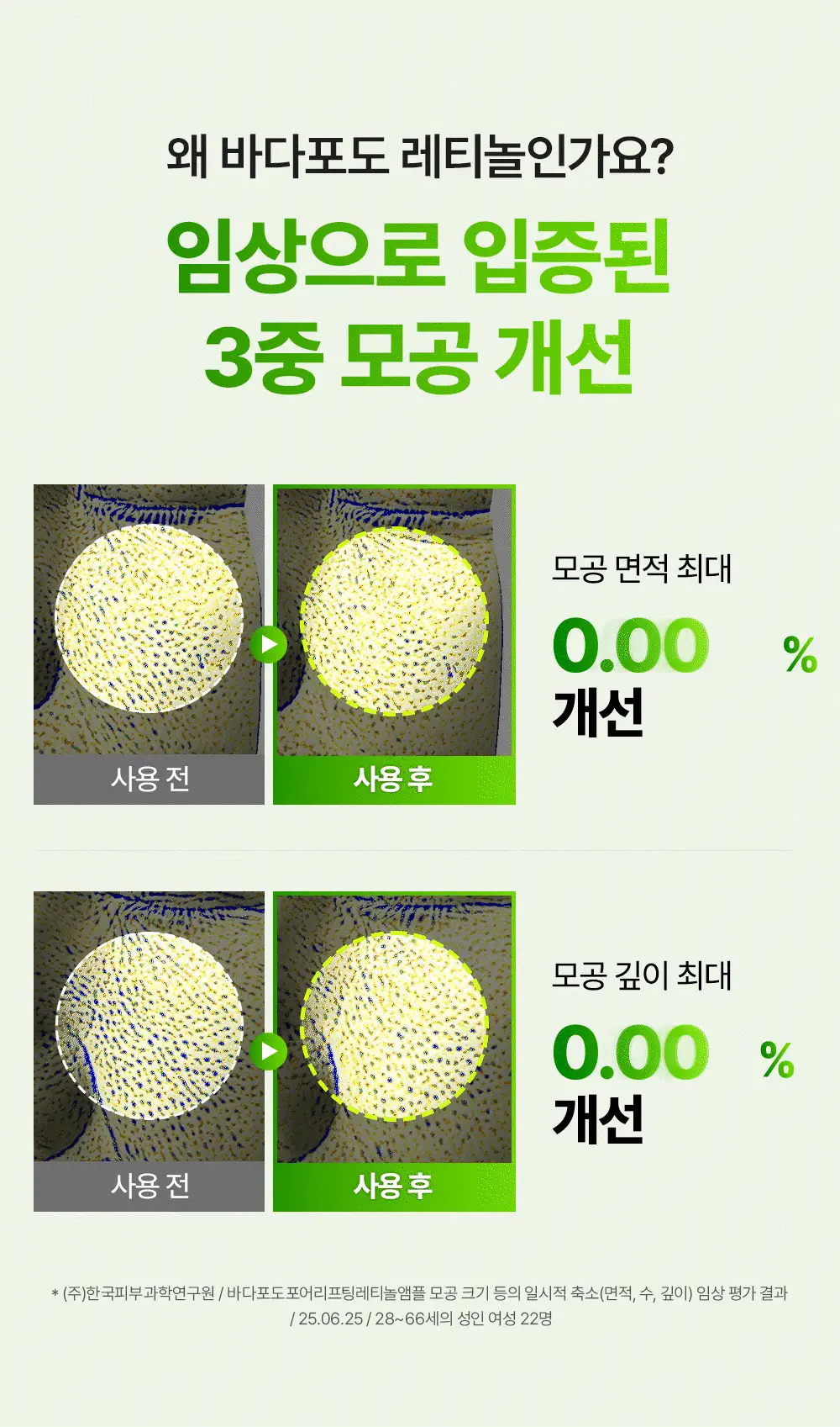 [1+1/핑구키링증정] 마미케어 바다포도 레티놀 모공앰플 50ml 리필기획(+핑구,핑가 키링 랜덤증정) 상세페이지 12